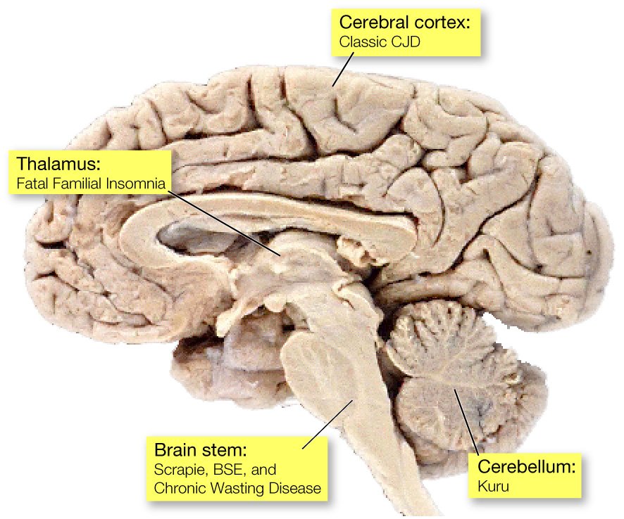 Cross section of the brain