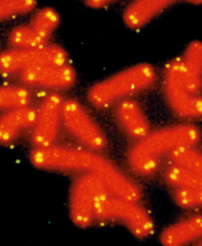 Fluoresence-stained chromosomes