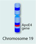 Alzheimers Chromosome