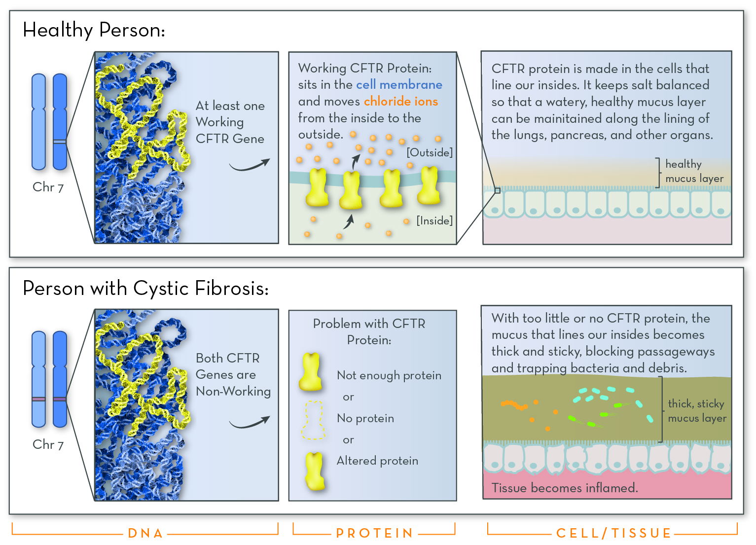 Cystic Fibrosis