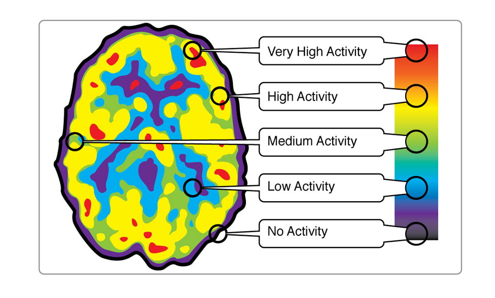 Brain Imaging Technologies
